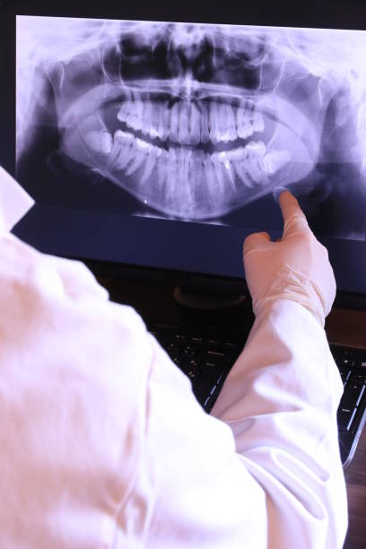 Best Emergency Tooth Extraction in Stewartville, AL