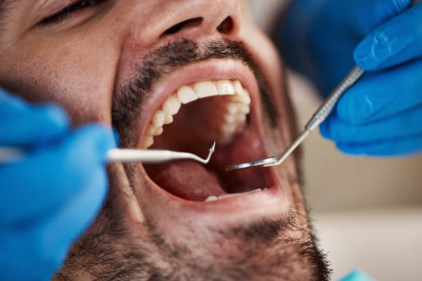 Best Emergency Dental Care for Broken or Chipped Teeth in Stewartville, AL